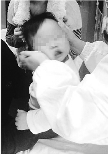 患儿接受推拿治疗。