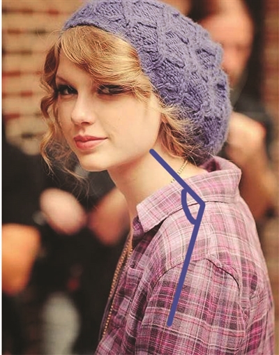 泰勒脖子为什么总是向前倾？保护颈椎注意两点