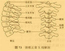 泰勒脖子为什么总是向前倾？保护颈椎注意两点