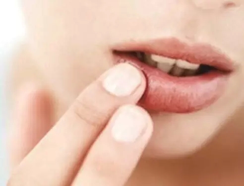 嘴唇长个小肿块 医院一查竟是癌!不做好防晒措施竟然还会得这病 嘴唇长个小肿块 医院一查竟是癌!不做好防晒措施竟然还会得这病