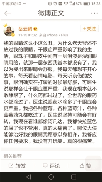 害惨了小岳岳的干眼症 最近确实高发 